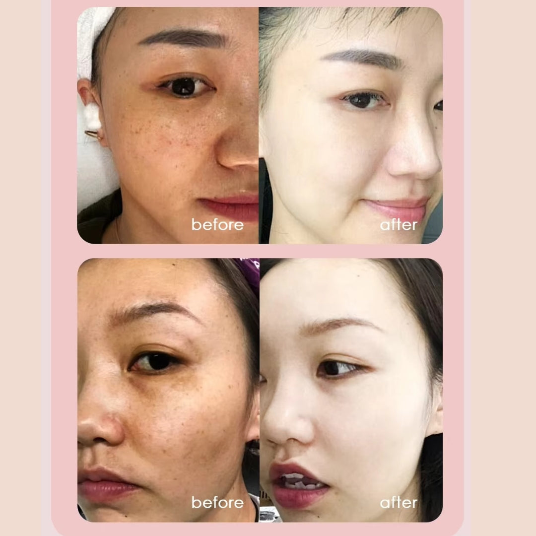 Beastcus Niacinamide Triple Brightening Action Serum