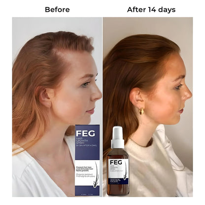 FEG Plus 👉( Men & women ) Hair Growth Spray ✅100% Original