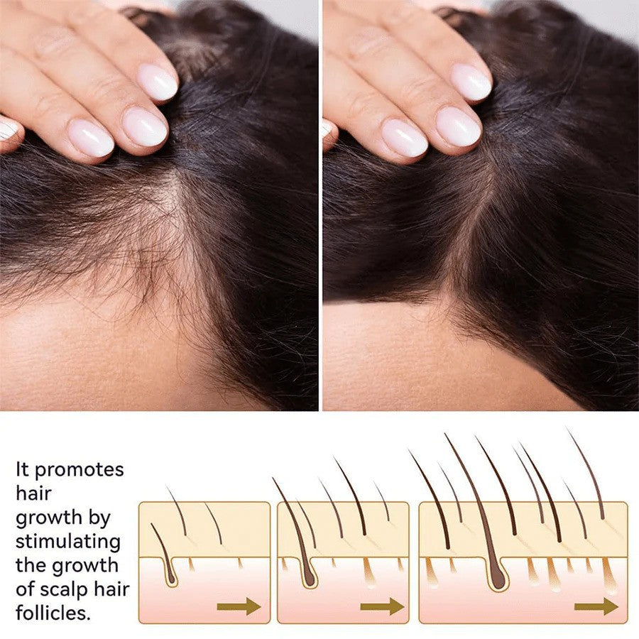 FEG Hair Growth Spray For Both Men & Women - FDA Approved