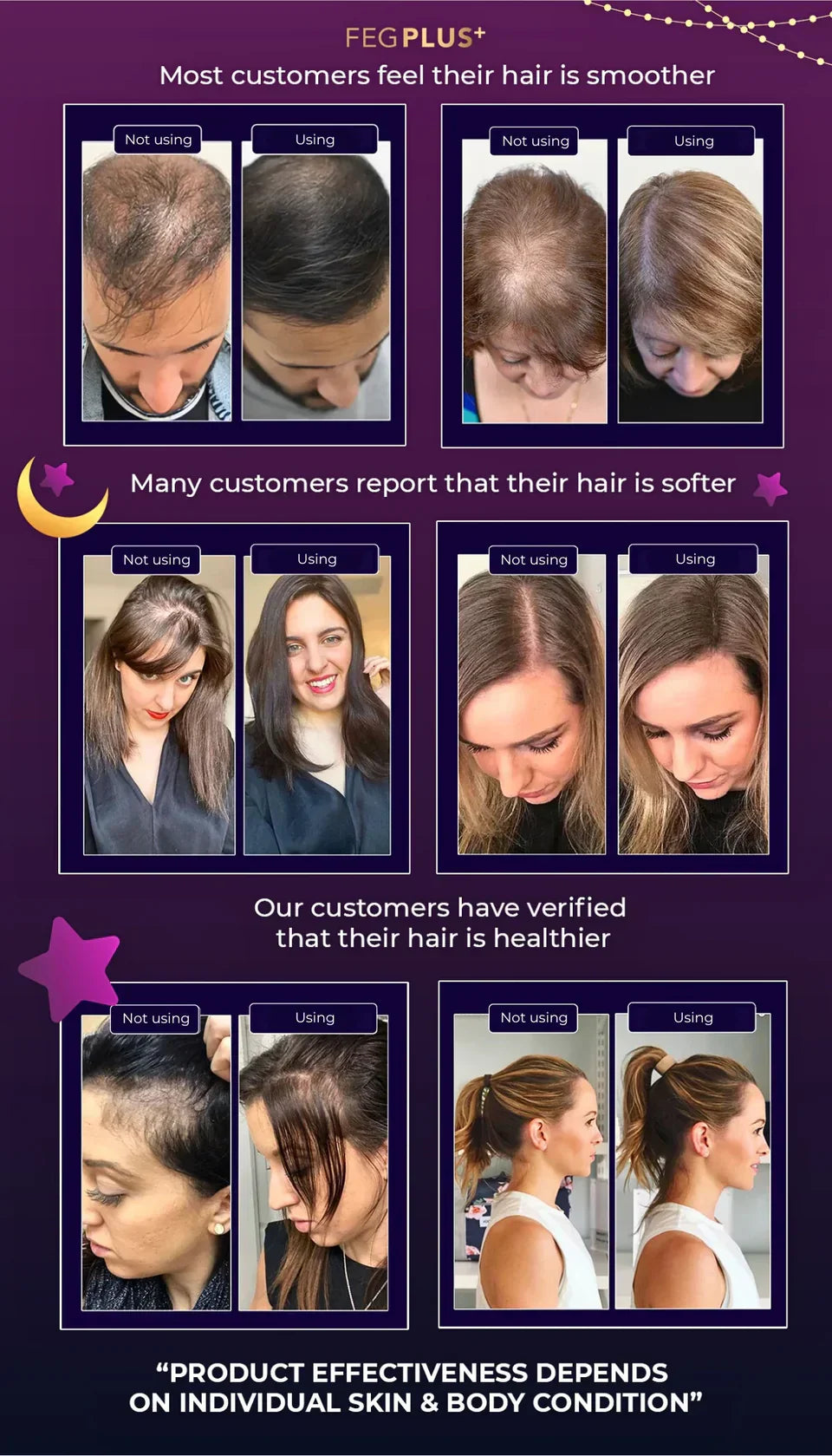 FEG Hair Growth Spray For Both Men & Women - FDA Approved