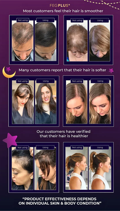 FEG Hair Growth Spray For Both Men & Women - FDA Approved